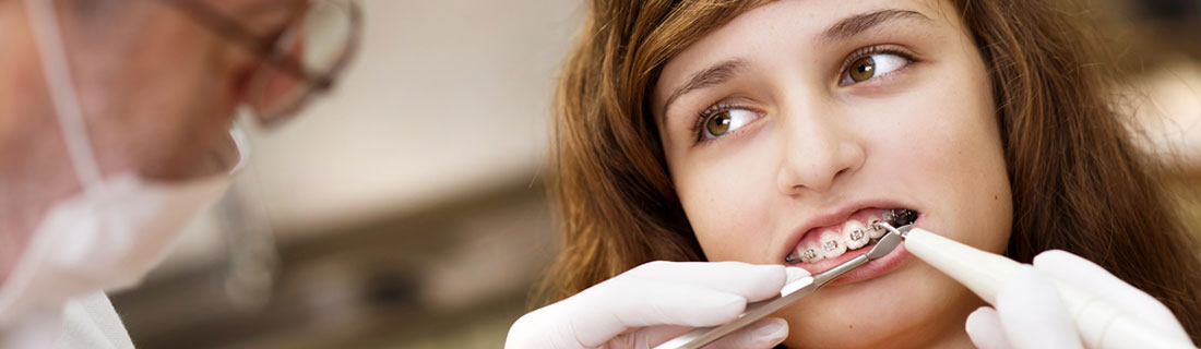 Family Dentist St Paul  Benefits of Using an Electric Toothbrush