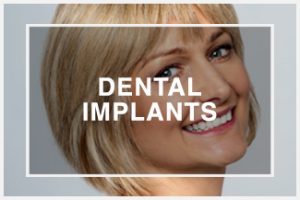 Symptoms Dental Implants