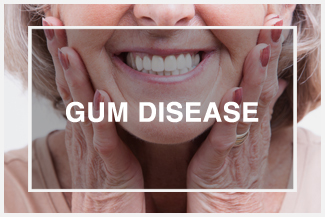 Symptoms Gum Disease