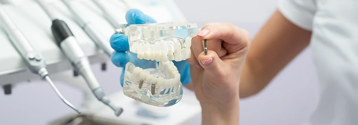 A bare hand holds a small screw up to a transparent figurine of a jaw featuring dental implants with similar screws