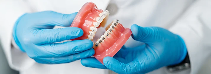Orthodontics-Braces-101-MultiORCS1.webp