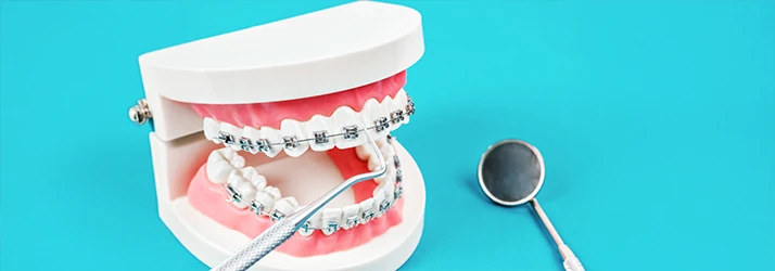 Dental model with metal braces next to dental tools on a turquoise background, highlighting orthodontic treatment. Dental model with metal braces next to dental tools on a turquoise background, highlighting orthodontic treatment.