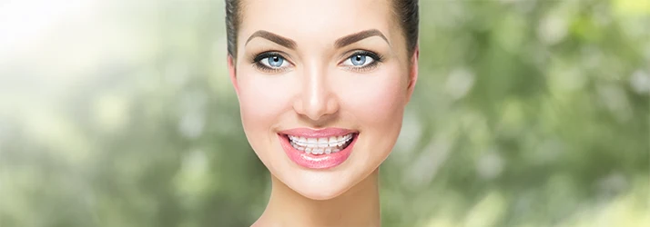 Portrait of a smiling woman wearing discreet ceramic orthodontic braces, highlighting aesthetic orthodontic treatment.