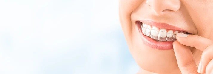 Orthodontics-Clear-Aligners-MultiORCS1.webp