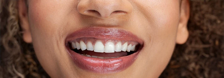Periodontist-Periodontal-Pocket-Reduction-CS1.webp Periodontist-Periodontal-Pocket-Reduction-CS1.webp