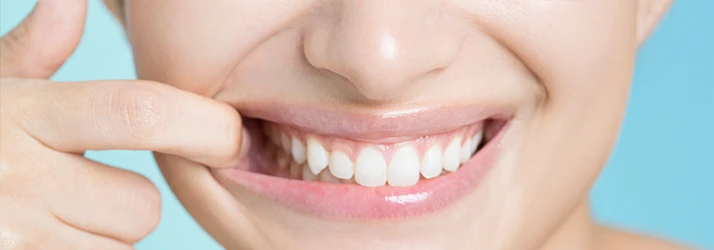 Close-up of a smiling patient showing healthy gums and teeth following successful periodontal pocket reduction by a periodontist.