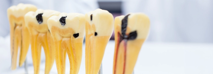 Cavities in CITY* STATE*