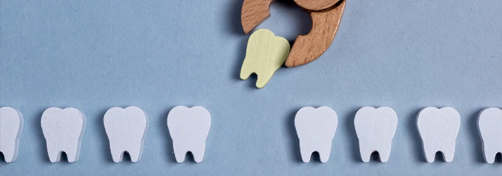 Tooth Extractions in CITY* STATE*