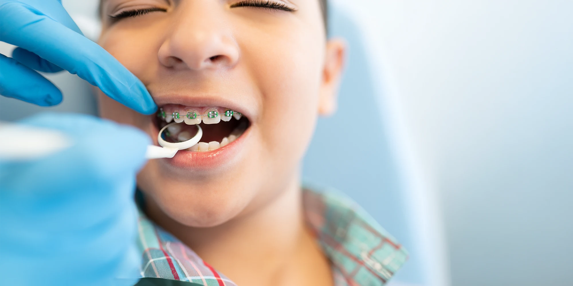 Child-with-Braces-Smiling-Wide-Orthodontist-Checking-Brackets.webp