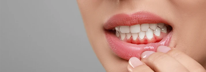 Person-With-Red-Inflammed-Gums-On-Grey-Background.webp