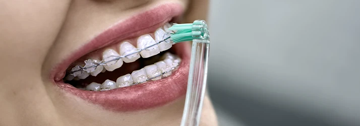 Specialty-Toothbrush-Being-Used-To-Clean-Braces.webp