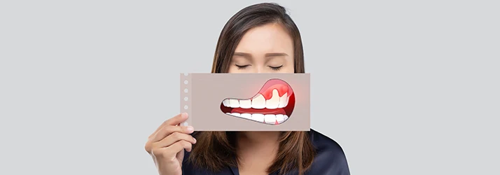 Woman-Who-Is-Ahamed-Of-Her-Gingivitis.webp